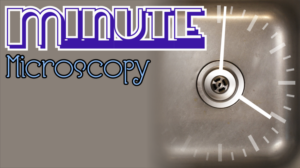 Minute Microscopy seeks to fit a rant into (about) a minute. From the controversial to the inane or absurd, this is the place for the short attention spans.